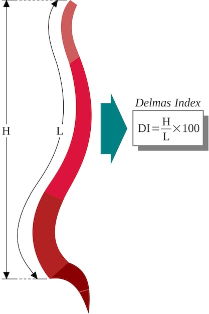 Delmas Index Diagram: Visualizing Structural Proportions | Jiffy Designs